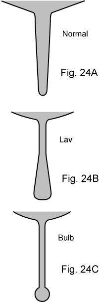 Fig-24A-C.gif